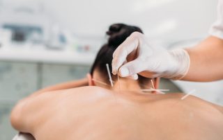 rmia-How-Can-Acupuncture-_-Supplements-Support-Your-IVF-Treatment-Journey