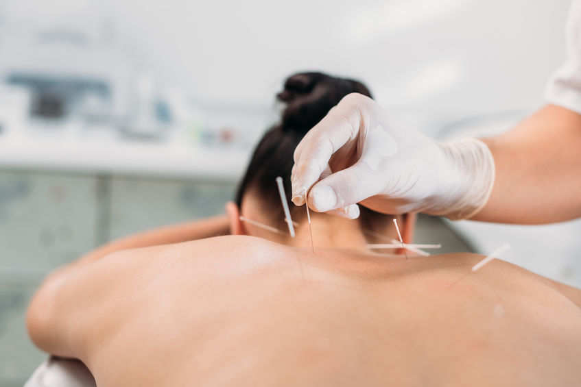 rmia-How-Can-Acupuncture-_-Supplements-Support-Your-IVF-Treatment-Journey rmia-How-Can-Acupuncture-_-Supplements-Support-Your-IVF-Treatment-Journey