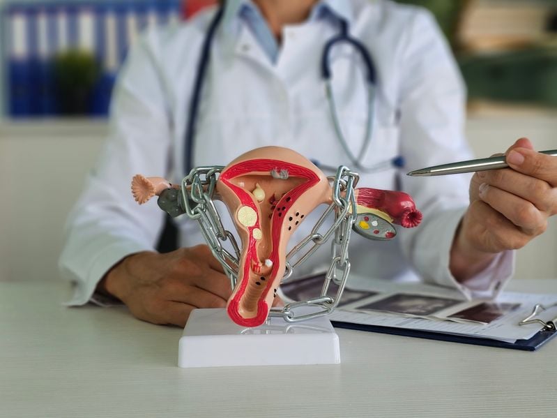 rmia How Can Uterine Fibroids Prevent Pregnancy and What Are Solutions