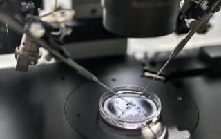 rmia Moving From IUI To IVF With ICSI After Repeated Failure