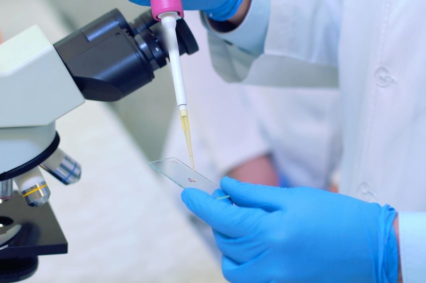RMIA-Using-Sperm-DNA-Fragmentation-Testing-To-Determine-The-Most-Effective-Fertility-Treatment
