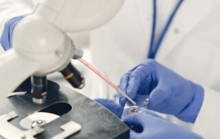 rmia-Severe-Oligospermia-Requires-Specific-Advanced-ICSI-Techniques-For-IVF